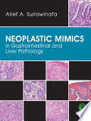 Neoplastic mimics in gastrointestinal and liver pathology /