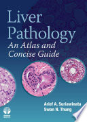 Liver pathology an atlas and concise guide /