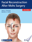 Facial reconstruction after Mohs surgery /
