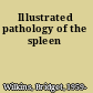 Illustrated pathology of the spleen
